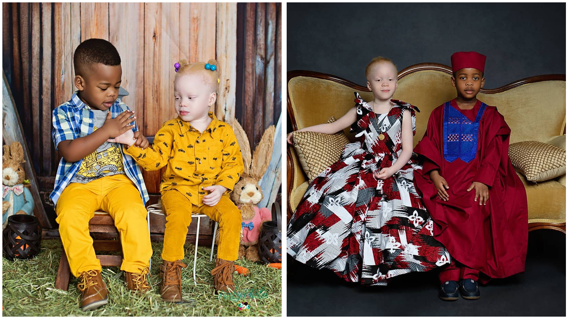 Photographer Welcomes Twins, One With A Dark Complexion And The Other Albino – I Believe They Are Absolutely Beautiful