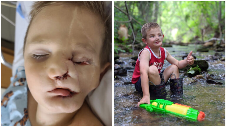 Ryder, 5, Triumphs Over An Attack By Two Dogs – Now Unkind Individuals Label Him A “Monster.