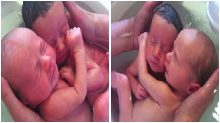 Newborn Twins Are Unaware They’ve Entered The World, Continuing To Snuggle Just Like They Did In The Comfort Of The Womb.