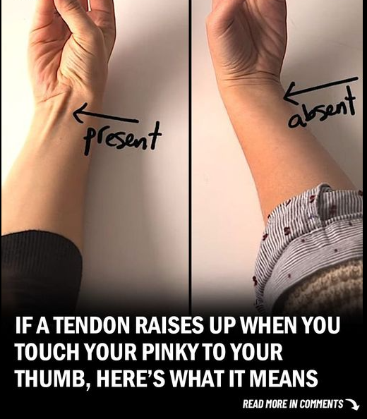 Tendon Raises Up