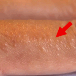 red bumps