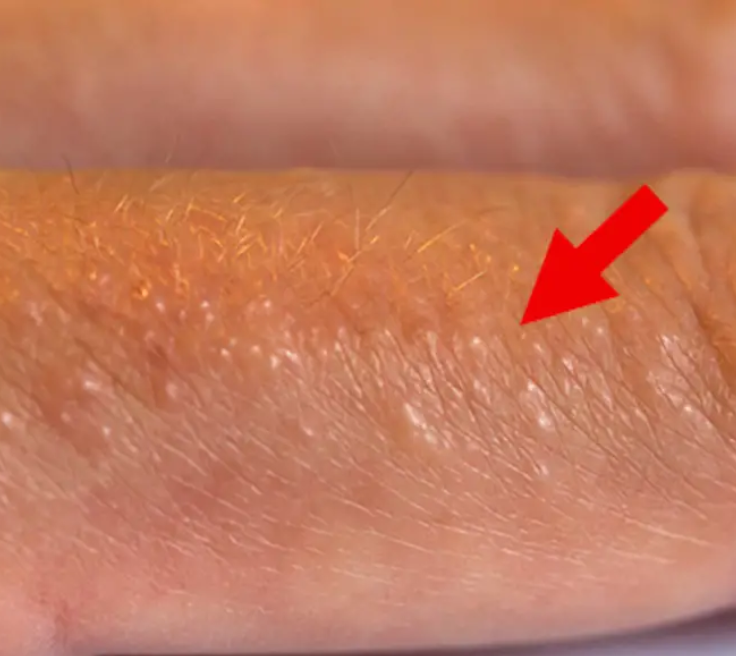 red bumps