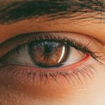 Eye Floaters