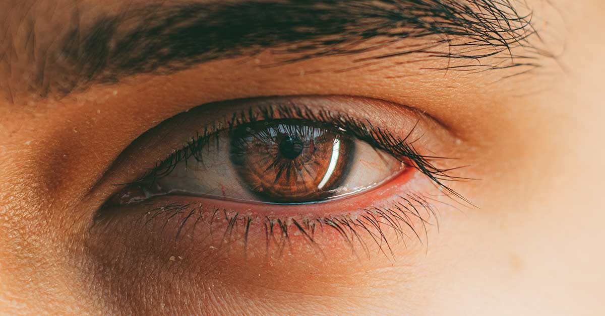 Eye Floaters