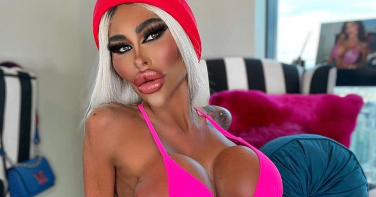 $200K on plastic surgery