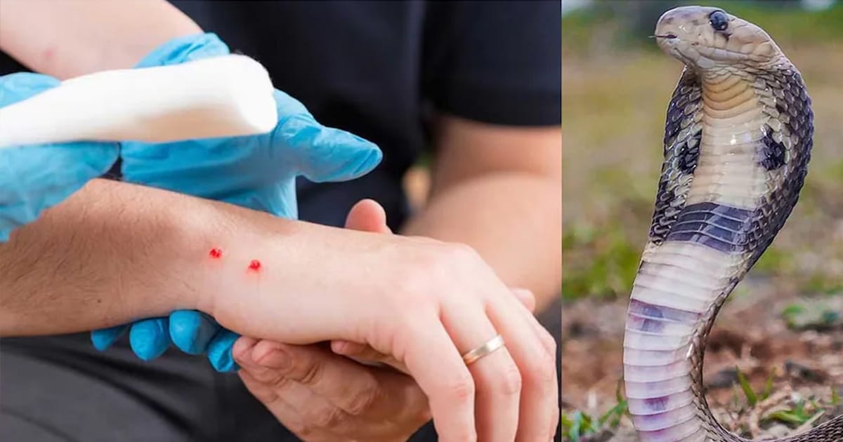 snake bite