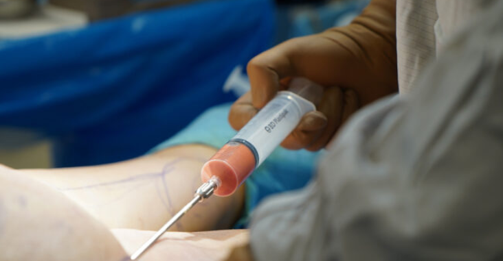 Botched BBL surgery leaves Florida woman permanently disabled