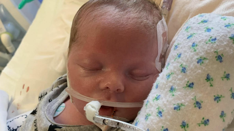 Parents say goodbye to their newborn as life support is switched off, then he immediately starts breathing