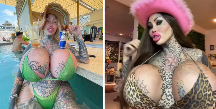 Tragic update on surgery‑addicted woman who wanted to become a “forest elf”