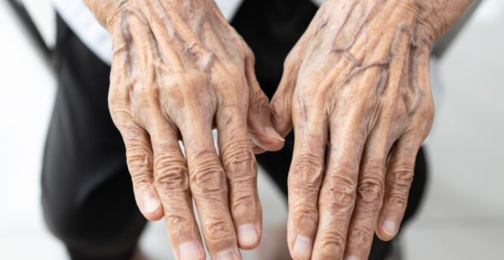If you see someone with bulging veins, make sure you tell them these things