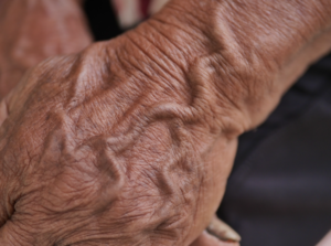 veins