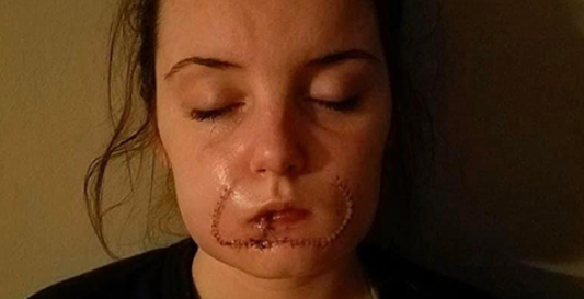 scarred