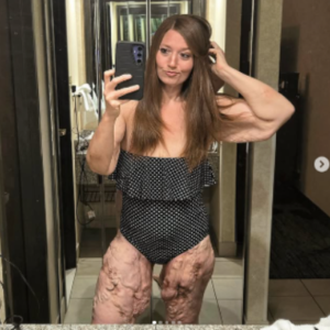 Transformation