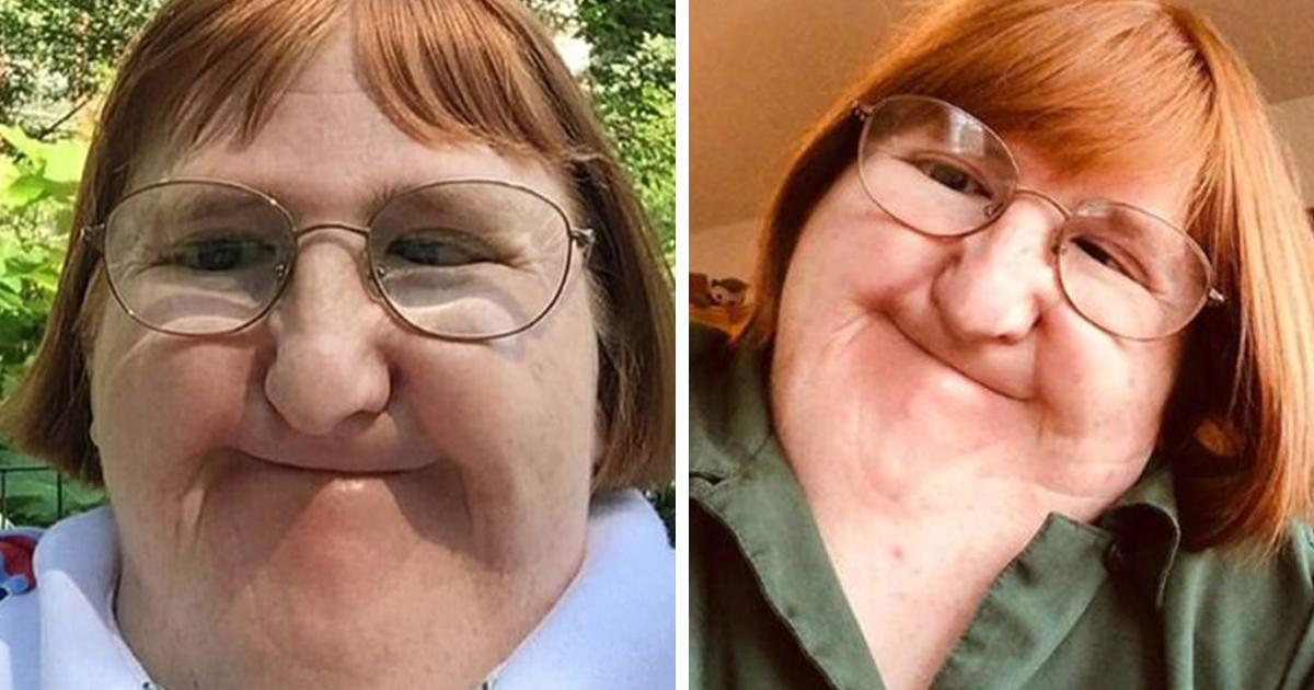 Bullied woman who was told she was ‘too ugly’ takes one selfie a day for a year