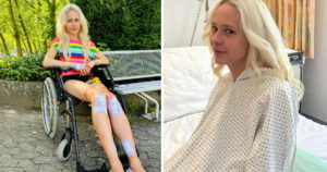surgery