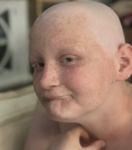 cancer 